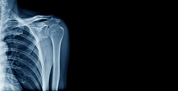 Dental X-Rays at Newstead
