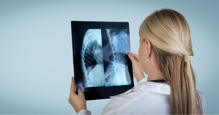 X-Ray Newstead Information for Patients